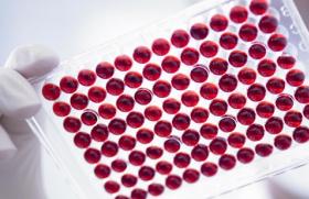 C-реактивный белок: определение заболеваний по биохимическому анализу крови
